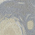 CDC190910E-04